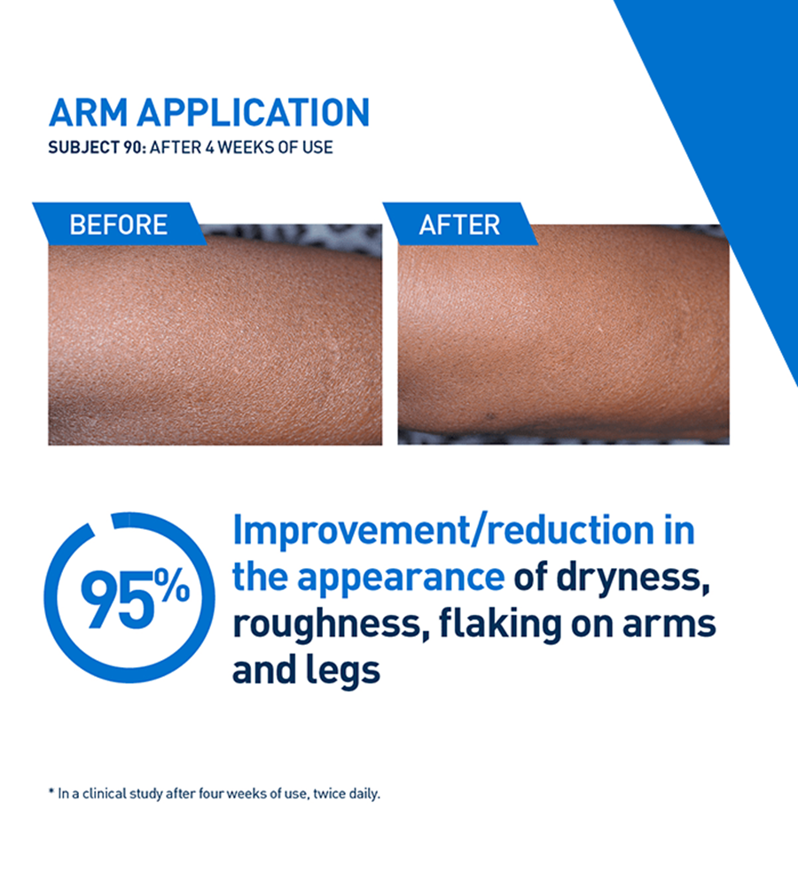 CeraVe Intensive Moisturizing Lotion for Dry to Very Dry Skin – 355ml - Image 2